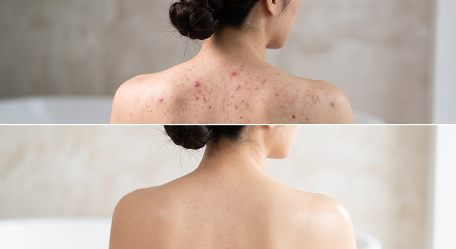 The bar built for the skin on your back.